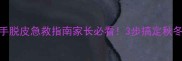 小宝宝手脱皮急救指南家长必看3步搞定秋冬小干皮